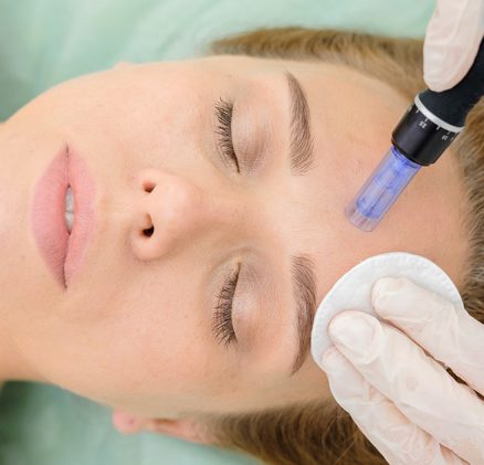 Micro-needling treatment in sharjah