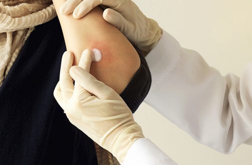 Skin infections treatment in sharjah
