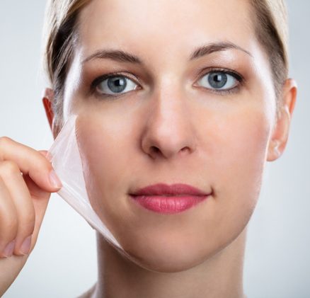 Chemical peels treatment in sharjah